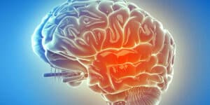 o que são inflamações no intestino